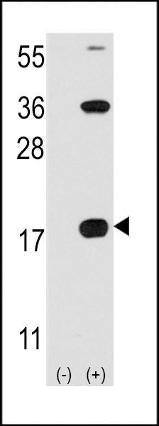 Western blot analysis of CD3Z (arrow) using rabbit polyclonal CD3Z Antibody (C-term) (Cat.#1413b).293 cell lysates (2 ug/lane) either nontransfected (Lane 1) or transiently transfected with the CD3Z gene (Lane 2) (Origene Technologies).