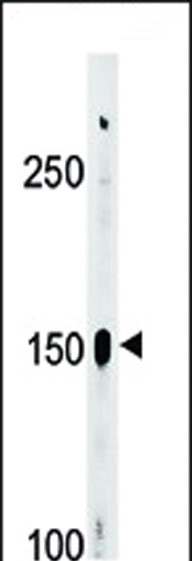 Western blot analysis of Phospho-ABL1(Y393)/ABL2(439)Antibody Pab (Cat. #AP3018a) in A2058 cell line lysate (35ug/lane). ABL (arrow) was detected using the purified Pab.