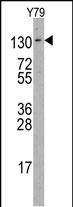 ABL2 non P-specific Pab (Cat.#AP3018b) western blot analysis in Y79 cell line lysates (35ug/lane). ABL2(arrow) was detected using the purified Pab.