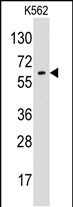 WB - Glypican 6 (GPC6) Antibody (N-term) AP6374a