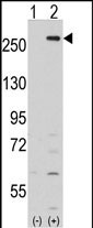 Western blot analysis of LMTK2 (arrow) using rabbit polyclonal LMTK2 Antibody (Center) (Cat.#AP7140c).293 cell lysates (2 ug/lane) either nontransfected (Lane 1) or transiently transfected with the LMTK2 gene (Lane 2) (Origene Technologies).