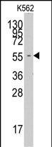 Western blot analysis of anti-FARSA Pab (Cat.#AP7566a) in K562 cell line lysates (35ug/lane).FARSA (arrow) was detected using the purified Pab.