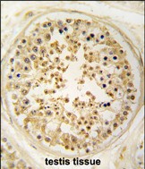 IHC-P - EARS2 Antibody (C-term) AP7573b