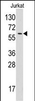 WB - Tyrosyl tRNA synthetase (YARS) Antibody (N-term) AP7580a