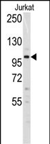 Western blot analysis of anti-Dnmt3a Antibody (N-term R46) (Cat.#AP1034d) in Jurkat cell line lysates (35ug/lane). Dnmt3a(arrow) was detected using the purified Pab.