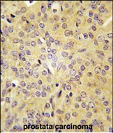 IHC-P - LARS Antibody (C-term) AP7413b