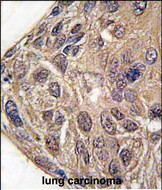 IHC-P - Tyrosyl tRNA synthetase (YARS) Antibody (C-term) AP7580b
