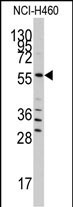 WB - SARS Antibody (C-term) AP7834B