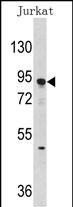 Western blot analysis of anti-DNMT3A Antibody (Center D472) (Cat.#AP1034c) in Jurkat cell line lysates (35ug/lane).DNMT3A(arrow) was detected using the purified Pab.