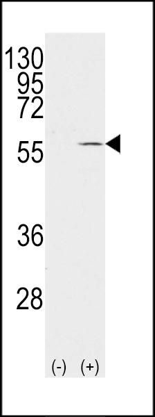 WB - Vimentin Antibody (S82) AP2739a