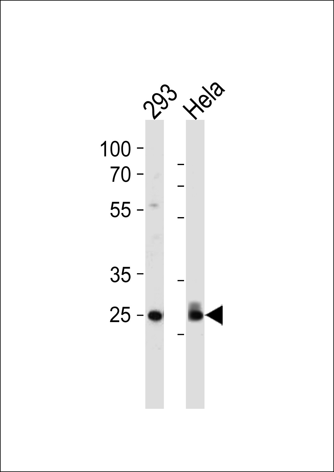 Cdk2 Antibody (T14) (Cat. #AP7518d) western blot analysis in 293,Hela cell line lysates (35ug/lane).This demonstrates the hCdk2 antibody detected the hCdk2 protein (arrow).
