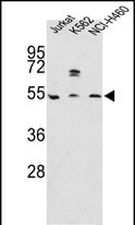 Western blot analysis of APOA4 Antibody (N-term) (Cat.#AP7591a) in Jurkat, K562, NCI-H460 cell line lysates (35ug/lane). APOA4 (arrow) was detected using the purified Pab.