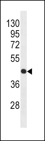 WB - Beta-actin Antibody (Ascites) AM1021a