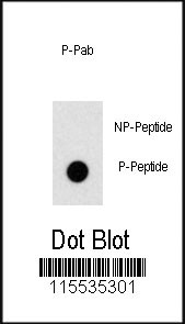 Dot blot analysis of anti-Phospho-ZBTB16-pY334 Antibody (Cat.#AP3575a) on nitrocellulose membrane. 50ng of Phospho-peptide or Non Phospho-peptide per dot were adsorbed. Antibody working concentrations are 0.5ug per ml.
