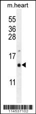 GNRH1 Antibody (N-term) (Cat.#AP7754a) western blot analysis in mouse heart tissue lysates (35ug/lane).This demonstrates the GNRH1 antibody detected the GNRH1 protein (arrow).