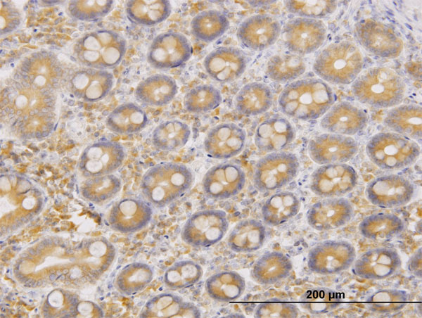 IHC - ERO1L Antibody (monoclonal) (M01) AT1946a