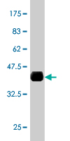 WB - ERO1L Antibody (monoclonal) (M01) AT1946a