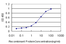 E - FABP1 Antibody (monoclonal) (M02) AT1984a