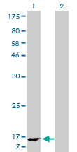 WB - FABP1 Antibody (monoclonal) (M02) AT1984a