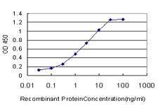 E - FADS3 Antibody (monoclonal) (M07) AT1990a