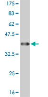 WB - FADS3 Antibody (monoclonal) (M07) AT1990a