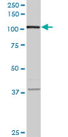 WB - FLJ20097 Antibody (monoclonal) (M01) AT2065a