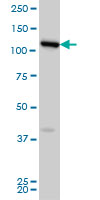WB - FLJ20097 Antibody (monoclonal) (M01) AT2065a