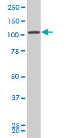 WB - FLJ20097 Antibody (monoclonal) (M01) AT2065a