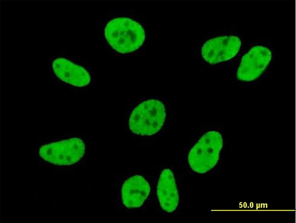 IF - FLJ20097 Antibody (monoclonal) (M01) AT2065a