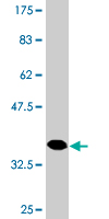 WB - HAPLN4 Antibody (monoclonal) (M12) AT2316a