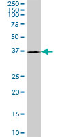 WB - HAPLN4 Antibody (monoclonal) (M12) AT2316a