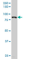 WB - HIC1 Antibody (monoclonal) (M01) AT2367a