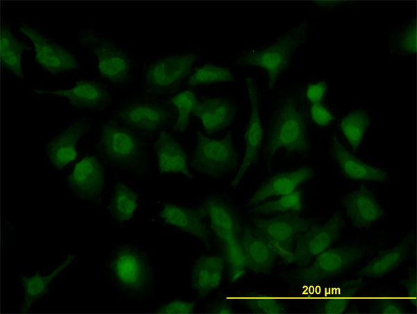 IF - HOXD11 Antibody (monoclonal) (M01) AT2425a