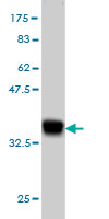 WB - HOXD11 Antibody (monoclonal) (M01) AT2425a