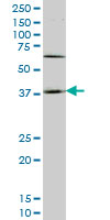 WB - HOXD11 Antibody (monoclonal) (M01) AT2425a