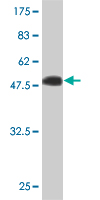 WB - IGSF6 Antibody (monoclonal) (M01) AT2495a