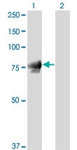 WB - JUP Antibody (monoclonal) (M01) AT2587a