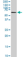 WB - MAK Antibody (monoclonal) (M01) AT2767a