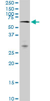 WB - MAK Antibody (monoclonal) (M01) AT2767a