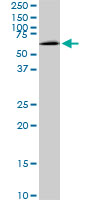 WB - MAK Antibody (monoclonal) (M01) AT2767a