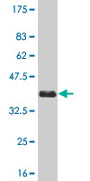 WB - MAK Antibody (monoclonal) (M02) AT2768a