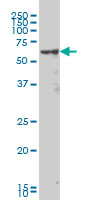 WB - MAK Antibody (monoclonal) (M02) AT2768a