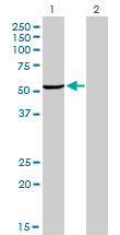 WB - MAK Antibody (monoclonal) (M02) AT2768a