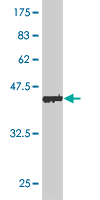 WB - MGC16186 Antibody (monoclonal) (M02) AT2860a