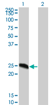 WB - MGC16186 Antibody (monoclonal) (M02) AT2860a