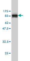 WB - MPP3 Antibody (monoclonal) (M01) AT2895a