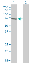 WB - MPP3 Antibody (monoclonal) (M01) AT2895a