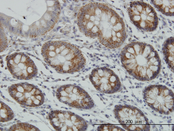 IHC - MT Antibody (monoclonal) (M01) AT2921a