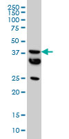 WB - MT Antibody (monoclonal) (M01) AT2921a