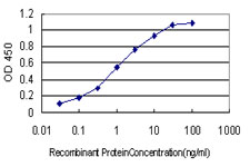 E - MYBPH Antibody (monoclonal) (M01) AT2945a